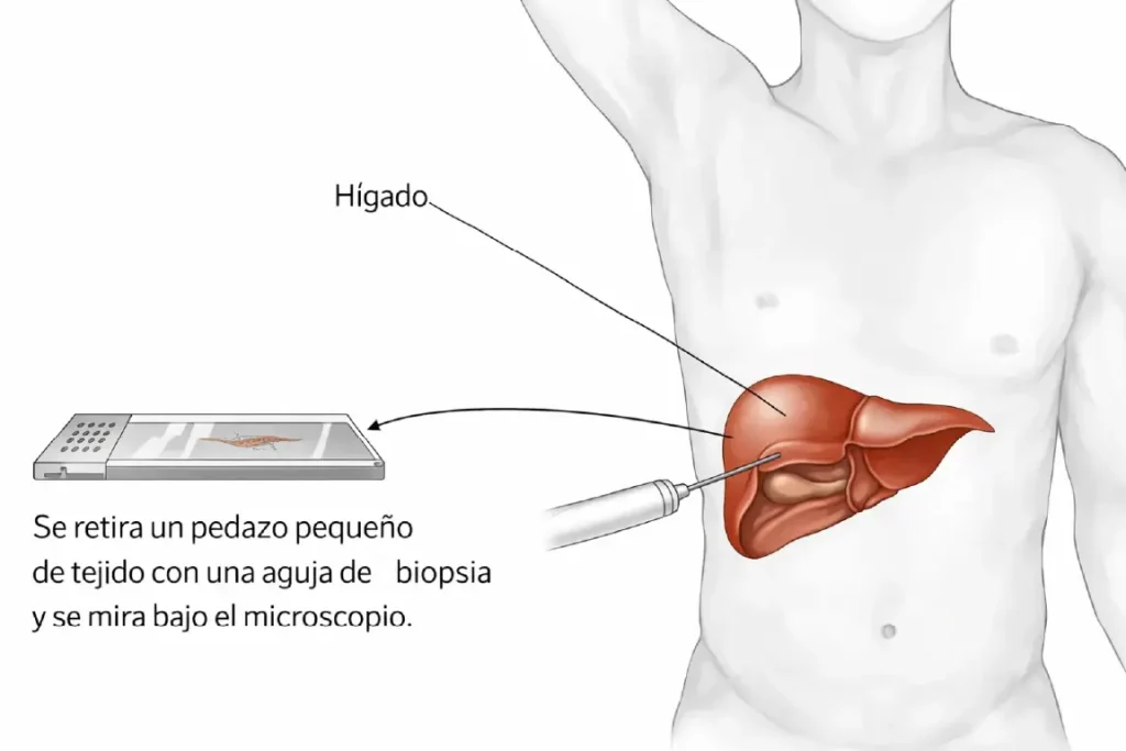 Posibles causas médicas asociadas a niveles elevados de vitamina B12
